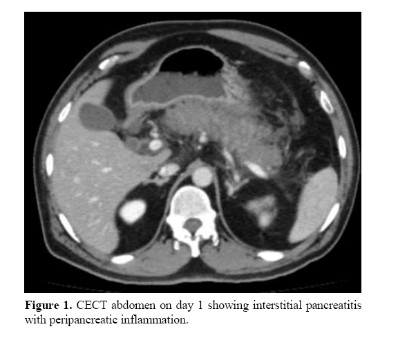 pancreas-peripancreatic-inflammation