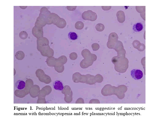 pancreas-peripheral-blood-smear