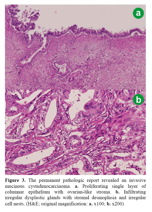 pancreas-permanent-pathologic-report