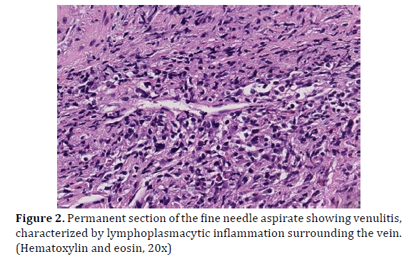 pancreas-permanent-section-aspirate