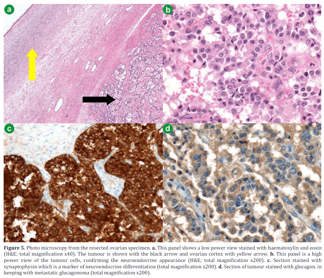 pancreas-photo-microscopy-ovarian