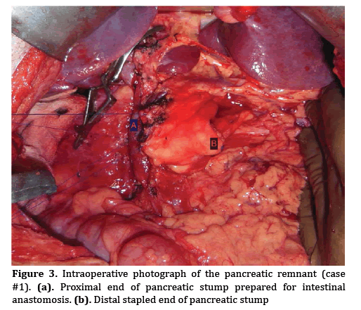 pancreas-photograph