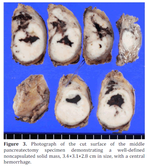 pancreas-photograph-cut-surface