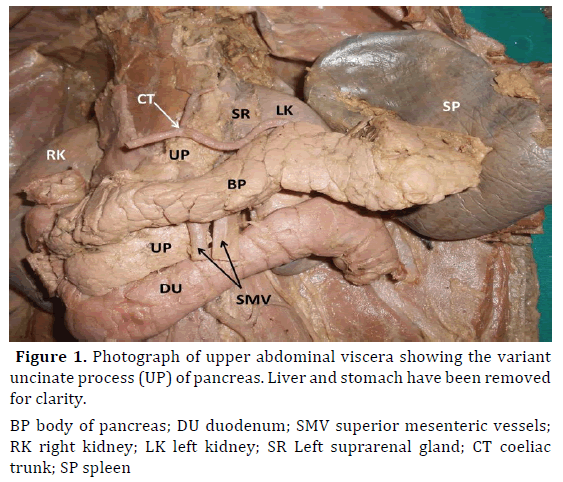 pancreas-photograph-upper-abdominal