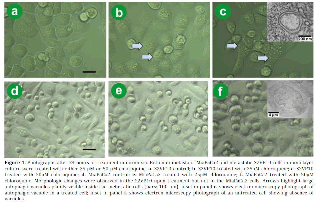 pancreas-photographs-treatment-normoxia