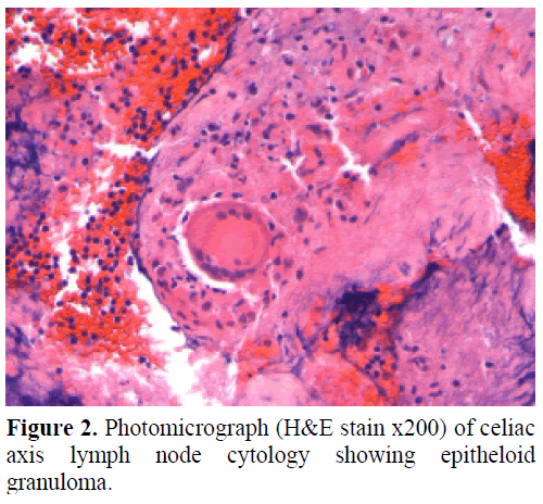 pancreas-photomicrograph-axis-lymph