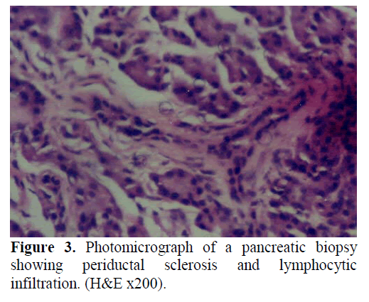 pancreas-photomicrograph-biopsy