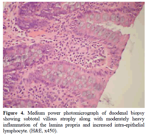 pancreas-photomicrograph-duodenal-biopsy