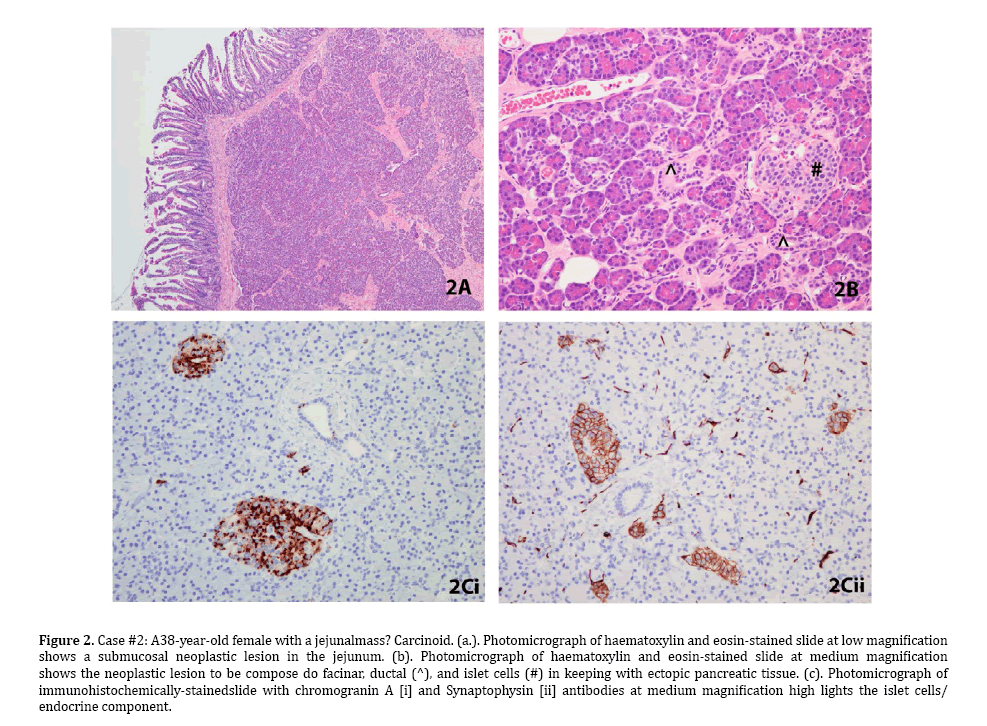 pancreas-photomicrograph-haematoxylin