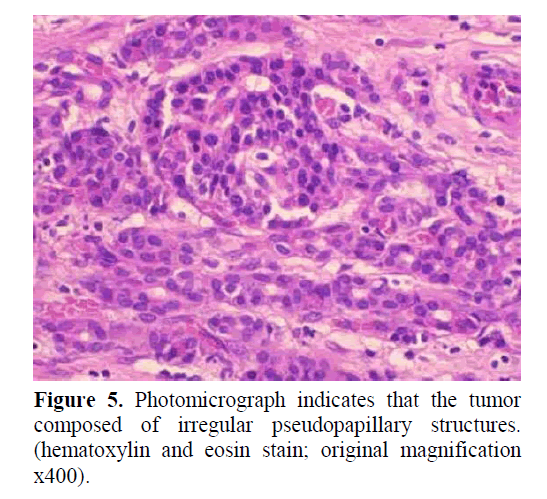 pancreas-photomicrograph-indicates