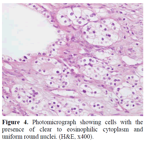 pancreas-photomicrograph-showing-cells