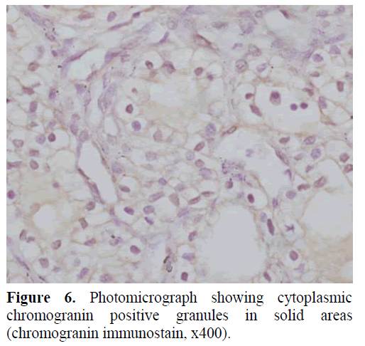 pancreas-photomicrograph-showing-cytoplasmic