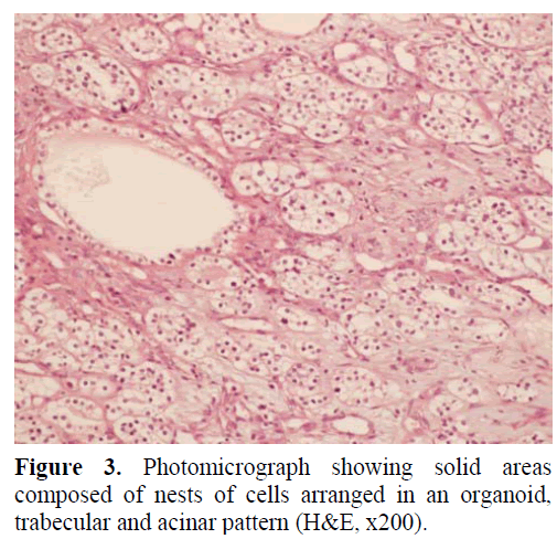 pancreas-photomicrograph-solid-areas