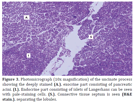 pancreas-photomicrograph-uncinate