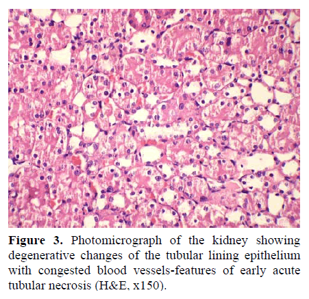 pancreas-photomicrographs-kidney