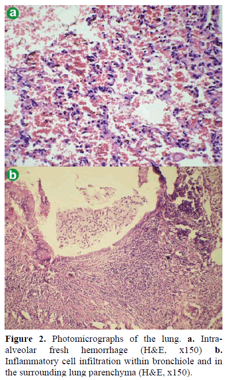 pancreas-photomicrographs-lung