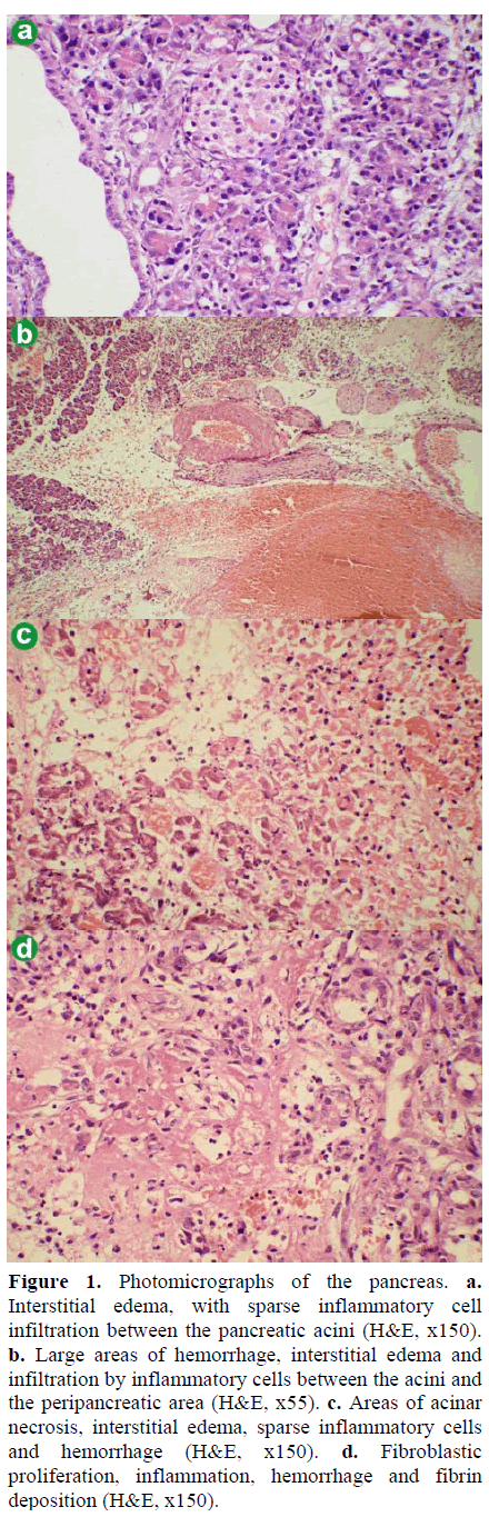 pancreas-photomicrographs-pancreas