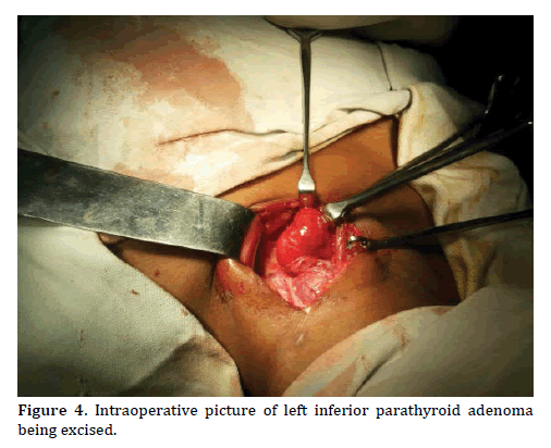 pancreas-picture