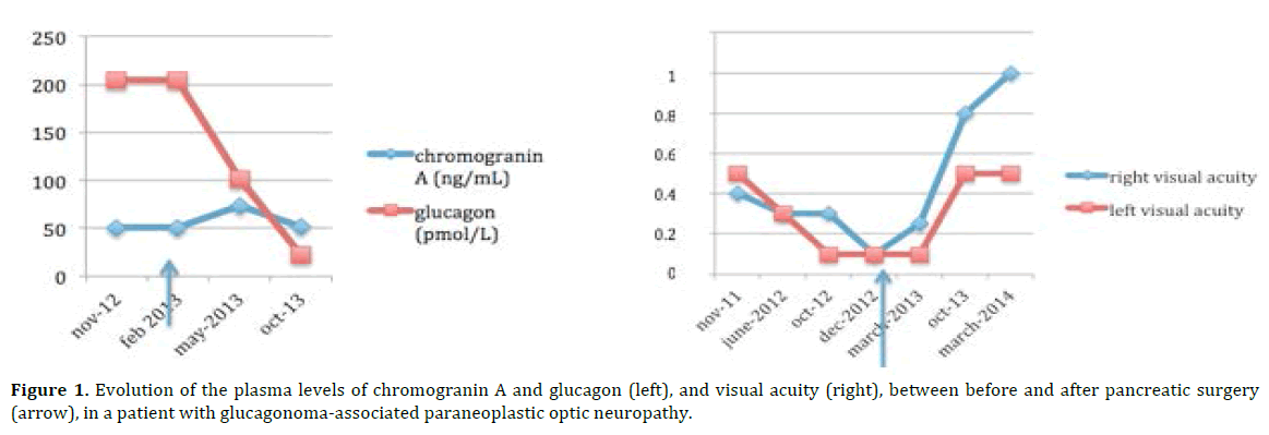 pancreas-plasma-levels-chromogranin