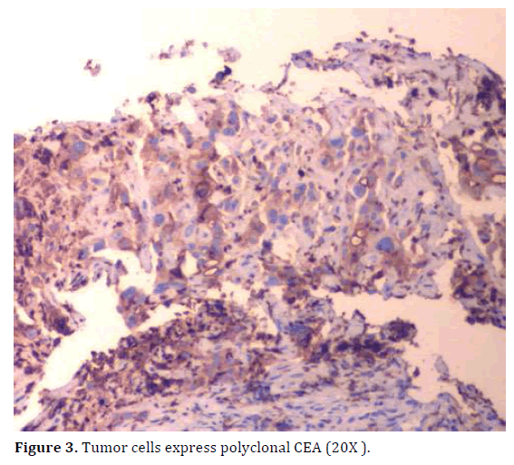 pancreas-polyclonal