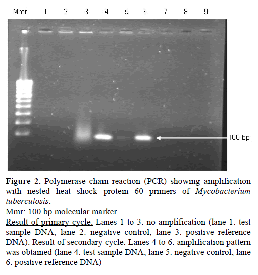 pancreas-polymerase-chain-reaction