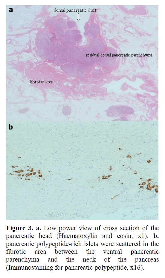 pancreas-polypeptide-rich-islets