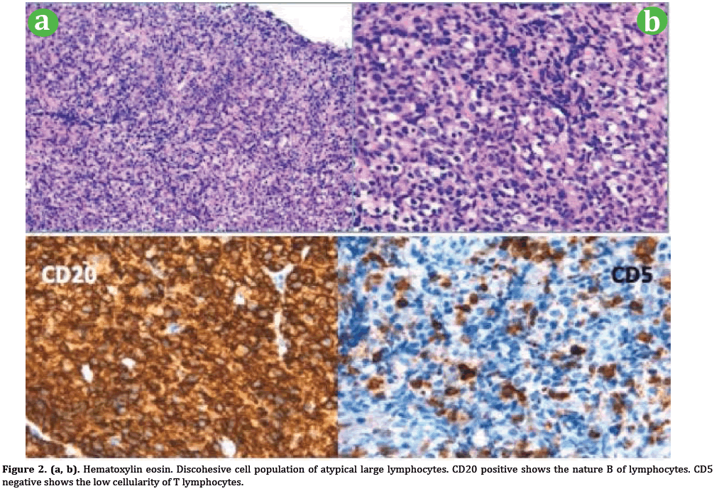 pancreas-population