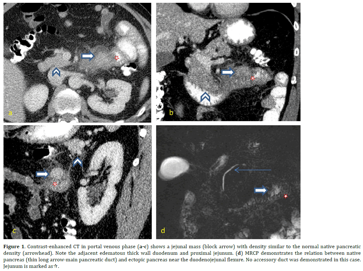 pancreas-portal-venous-phase