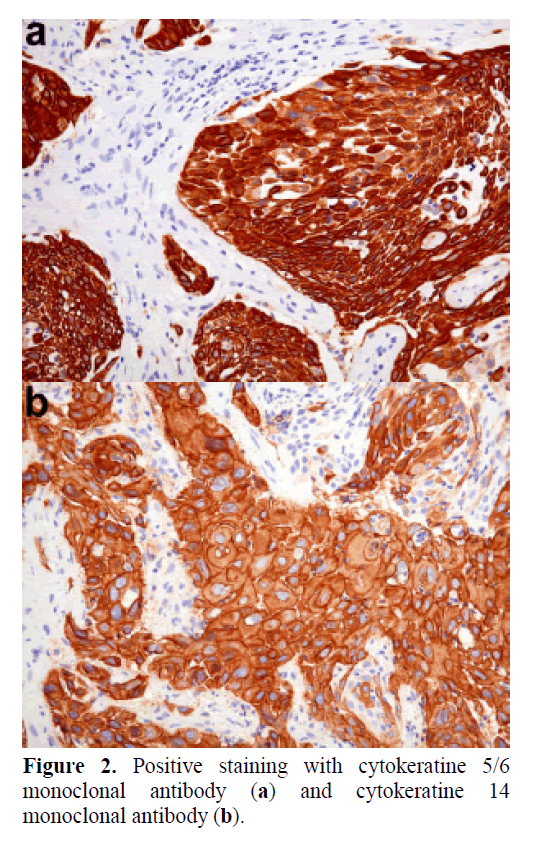 pancreas-positive-staining-cytokeratine