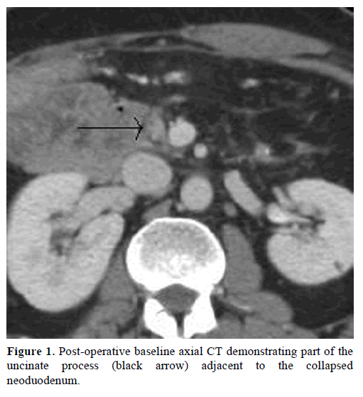 pancreas-post-operative-baseline-axial