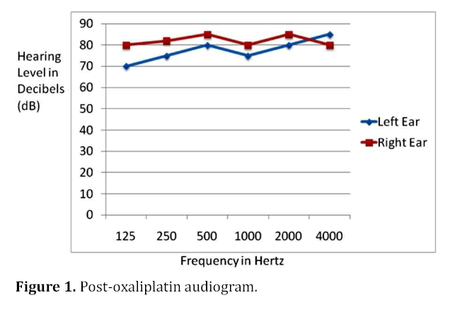 pancreas-post-oxaliplatin-audiogram