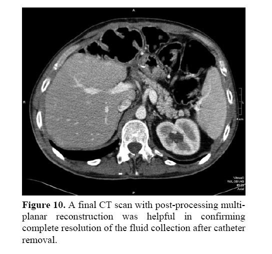 pancreas-post-processing-multiplanar