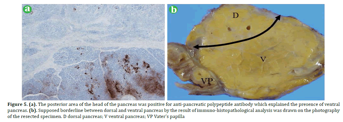 pancreas-posterior-area-polypeptide