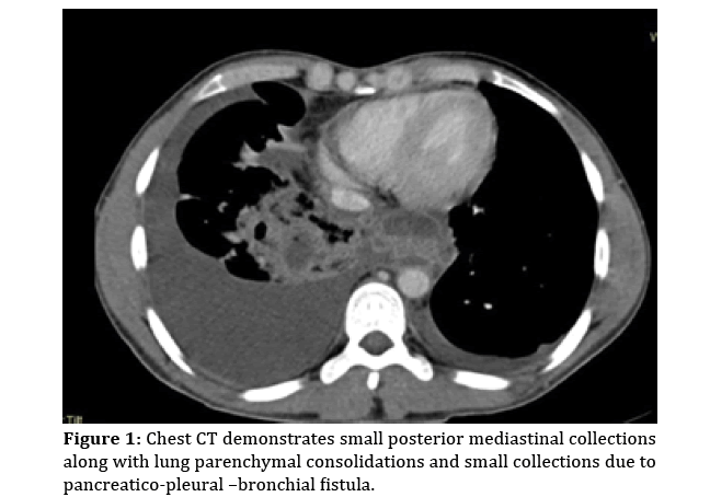 pancreas-posterior-mediastinal-collections