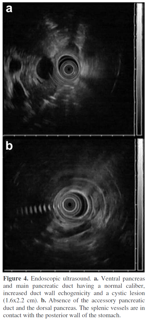 pancreas-posterior-wall-stomach