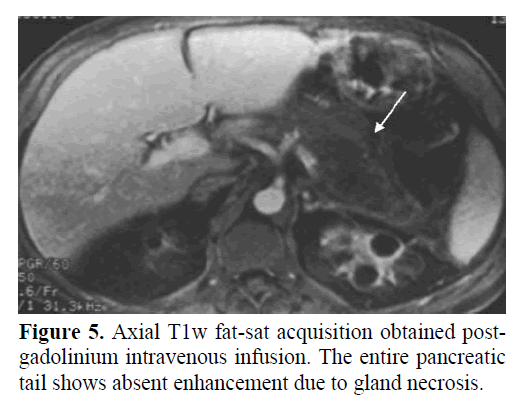 pancreas-postgadolinium-intravenous