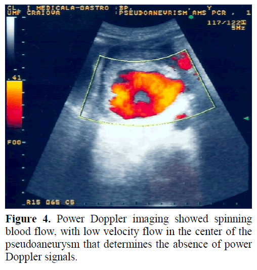 pancreas-power-doppler-imaging-spinning
