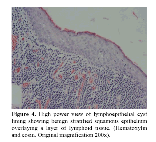 pancreas-power-view-lymphoepithelial