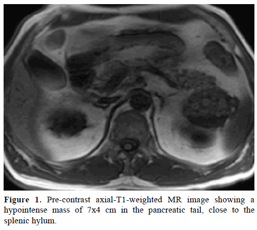 pancreas-pre-contrast-axial-t1-weighted