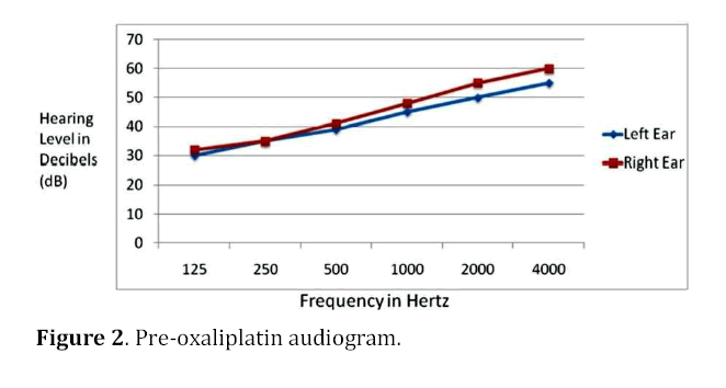 pancreas-pre-oxaliplatin-audiogram