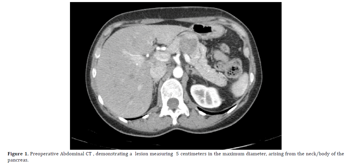 pancreas-preoperative-abdominal-ct