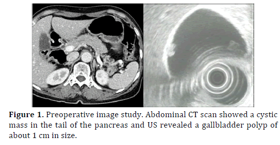 pancreas-preoperative-image-study