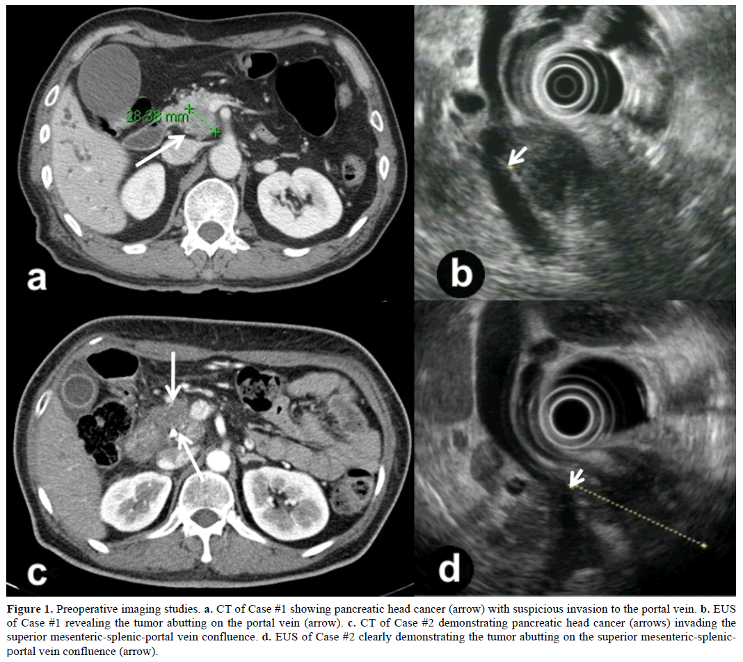 pancreas-preoperative-imaging-studies
