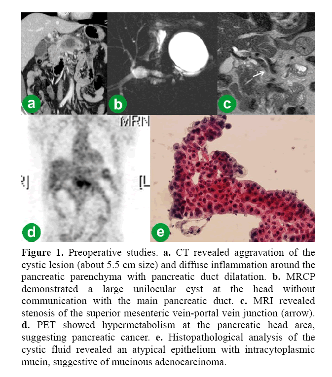pancreas-preoperative-studies