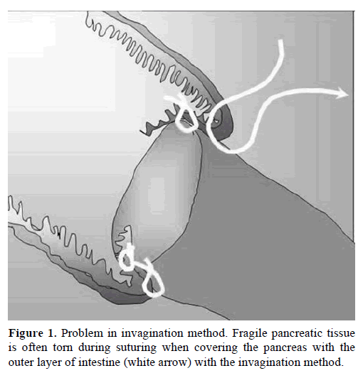 pancreas-problem-invagination-method
