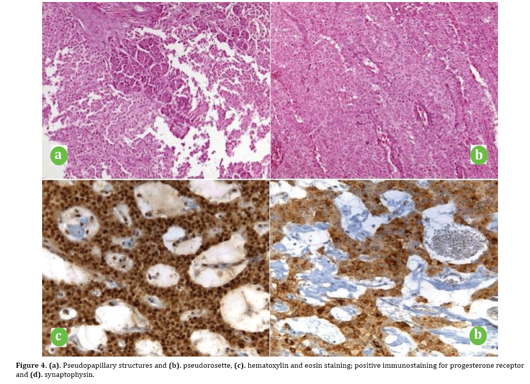 pancreas-progesterone