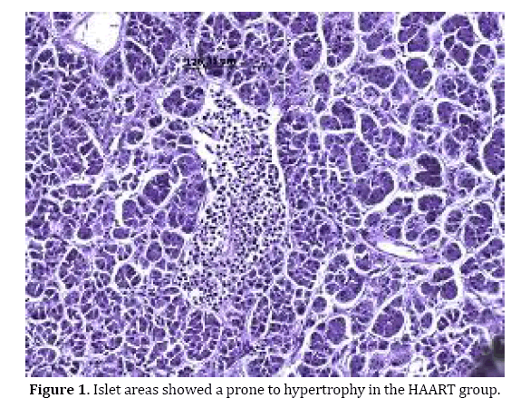 pancreas-prone-hypertrophy