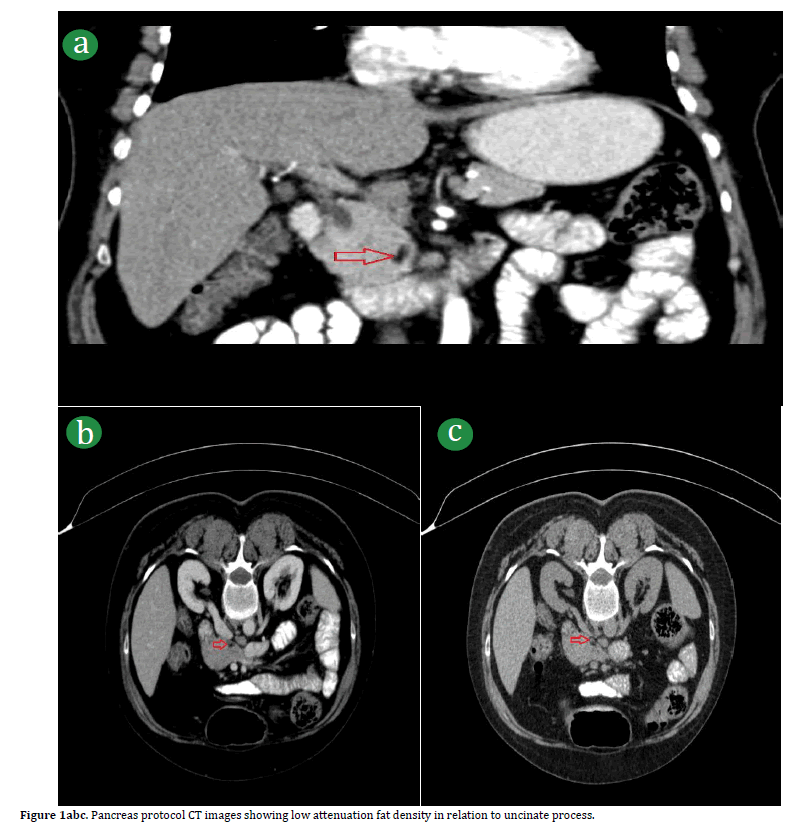 pancreas-protocol