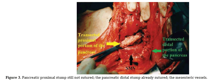 pancreas-proximal