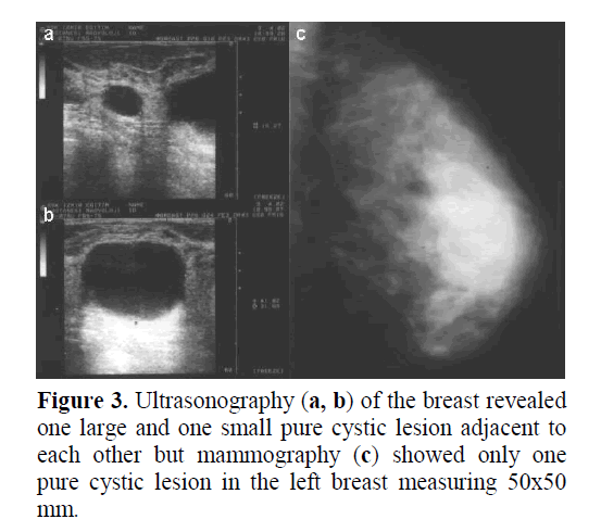 pancreas-pure-cystic-lesion